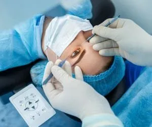 Cirurgia de Miopia